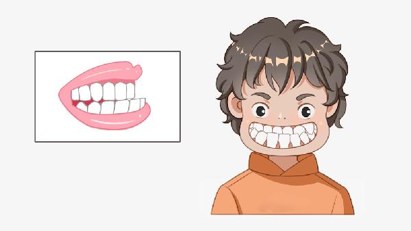 做地包天矯正價(jià)格