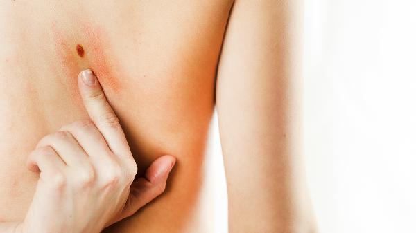 面部皮膚干燥怎么辦