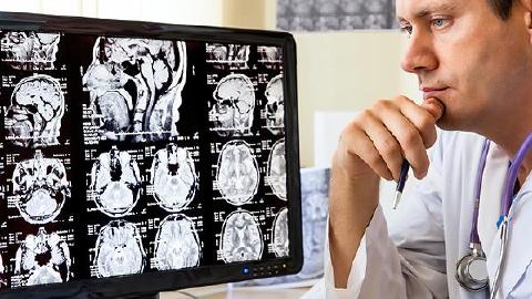 經(jīng)常造成小兒化膿性腦膜炎的是