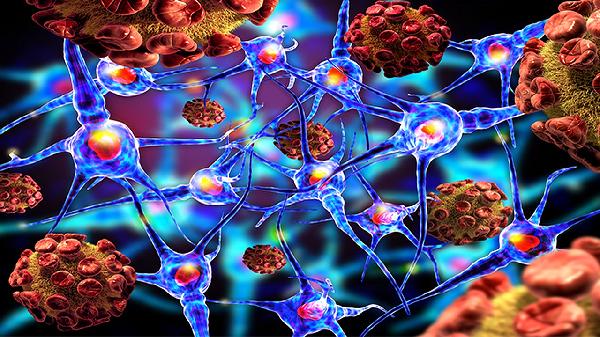 鼻癌是什么原因引起的