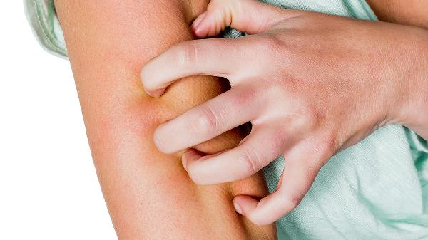 鮑溫樣丘疹病跟黑痣怎么區(qū)分