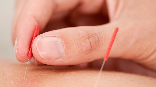 針灸出血：是正?，F象還是扎針不準 針灸出血沒(méi)事吧