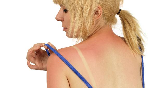 肩膀撞伤后第二天抬不起来