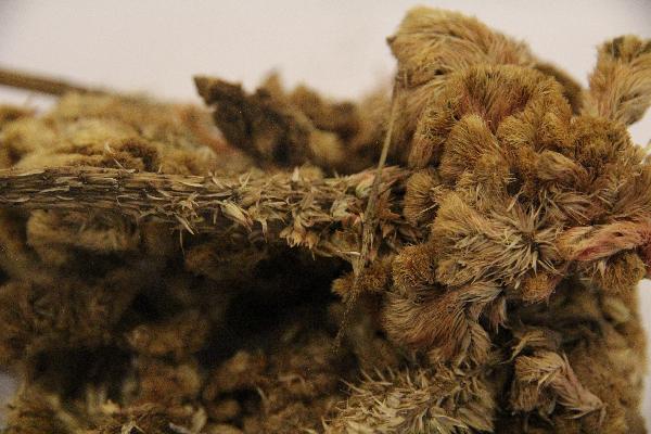 中醫(yī)治療腰間盤突出最有效方法