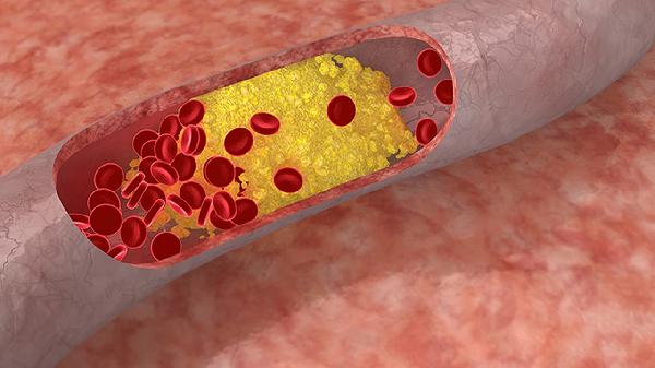 正常尿里一個紅細胞都沒有嗎