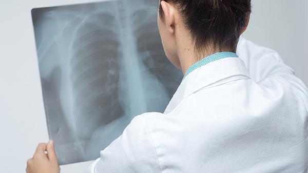 肺大泡必須戒煙嗎