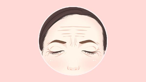 抬頭紋可以去除嗎