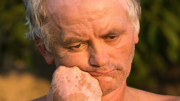 皮肤干燥缺水怎么办