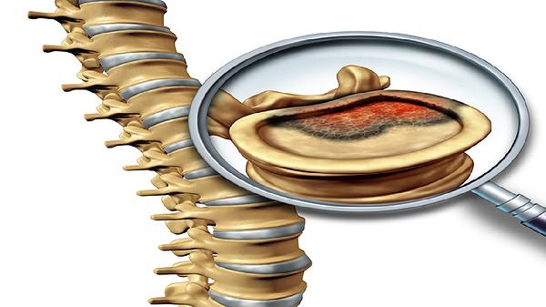 尾椎骨兩邊疼是怎么回事