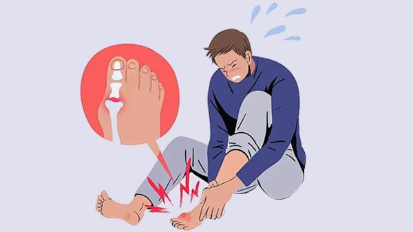 膝蓋骨折腫脹多久能消腫