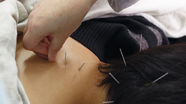 埋線(xiàn)降解后依然有效嗎