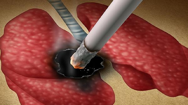 吸烟会诱发肺癌的原因