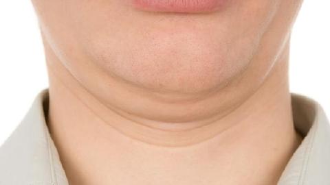 雙下巴運動能減掉嗎