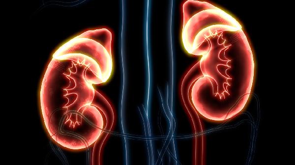 肾小球肾炎是什么性炎症类型