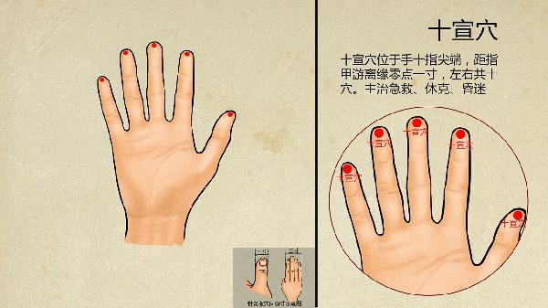 中醫(yī)對腰間盤突出的辨證論治