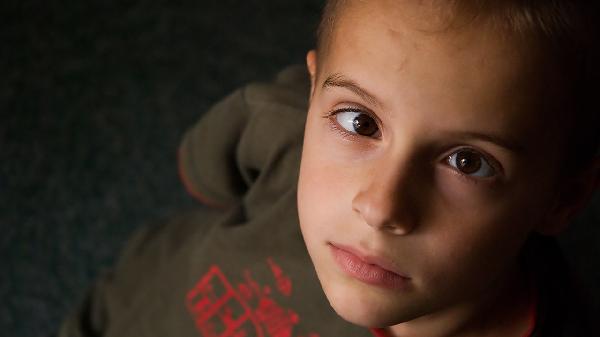 兒童早衰癥怎么引起的