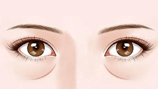 做除淚溝要花多長(cháng)時(shí)間