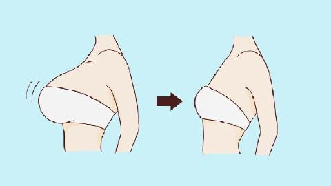 巨乳縮小術(shù)的好處