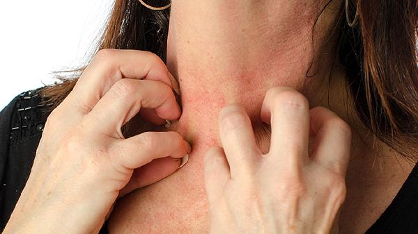 頸動(dòng)脈瘤介入術(shù)后皮膚青紫