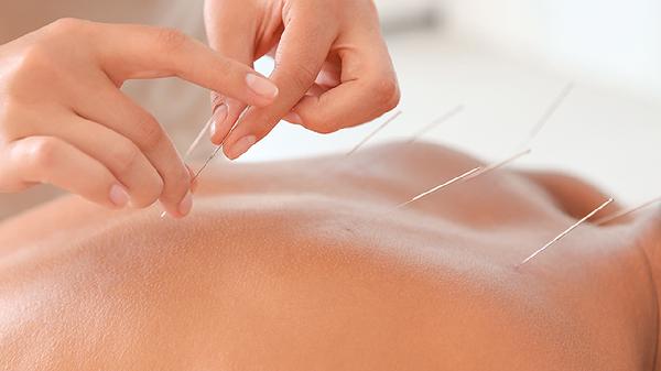埋線(xiàn)針灸過(guò)度的危害