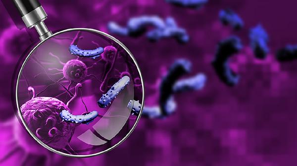 細菌性痢疾的腸道典型病變