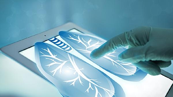 肺癌持續(xù)發(fā)燒怎么辦