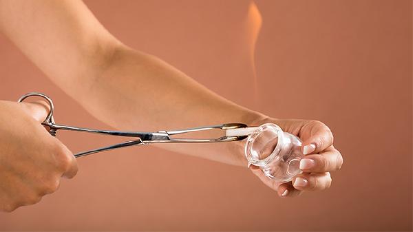 足底拔火罐會痛說明什么 足底拔罐的壞處