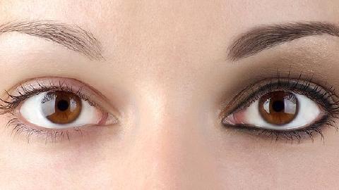 激光去眼袋要多少錢啊