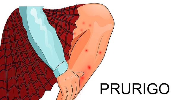 胳膊細腿粗是什么體質(zhì)的人