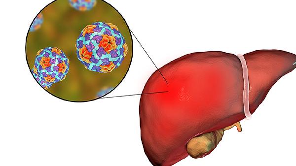 吃什么东西能预防肝癌