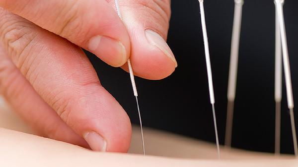 為什么不建議針灸膝蓋 針灸對膝蓋有害