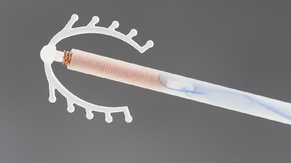 女人帶節育環(huán)有什么副作用