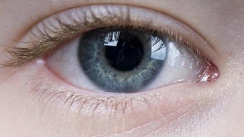 眼角周周怎么老是長脂肪粒