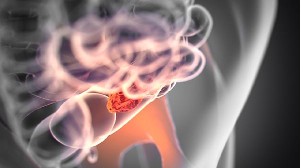 腸旋轉(zhuǎn)手術(shù)有后遺癥嗎