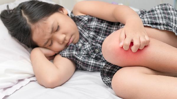 怎么分辨風(fēng)濕和類風(fēng)濕癥狀