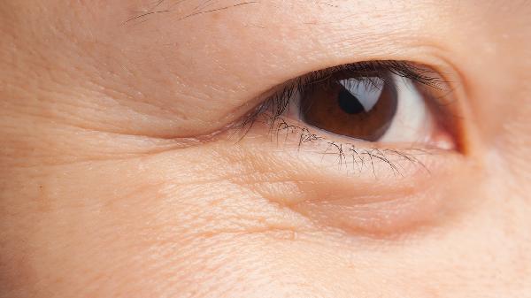 眼部有皺紋怎么消除