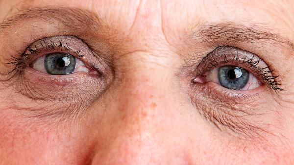 面部18種皺紋有哪些