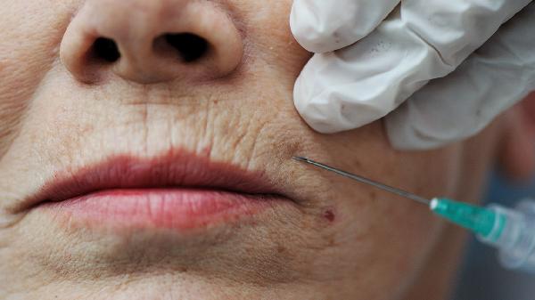 頭大臉大怎么改善