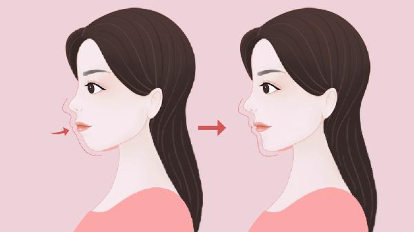 正頜手術(shù)是怎么做的