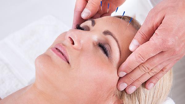 針灸埋線幾次有效果