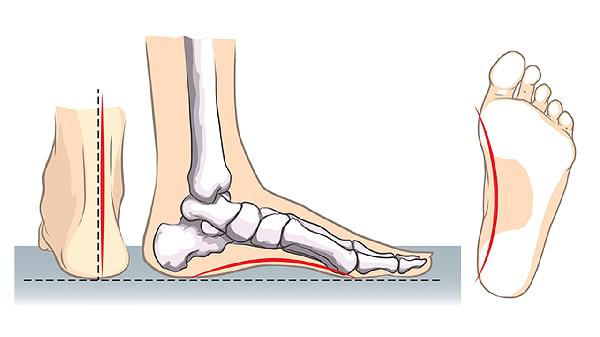 骨骼閉合了還有什么辦法可以長高