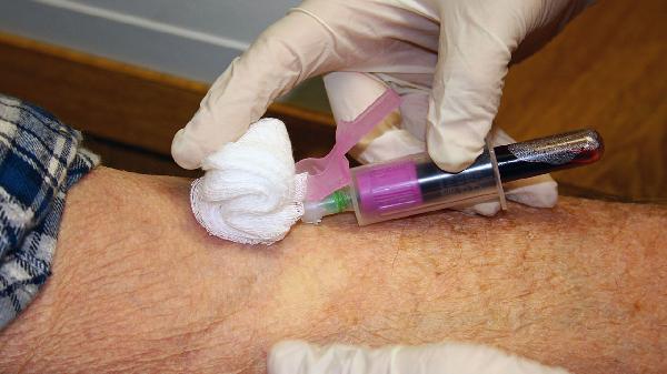 降血血脂的水果有哪些