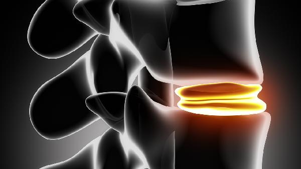 脊椎脫位和滑脫的區(qū)別