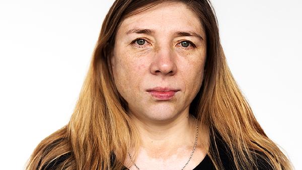 怎样去掉脸上的油