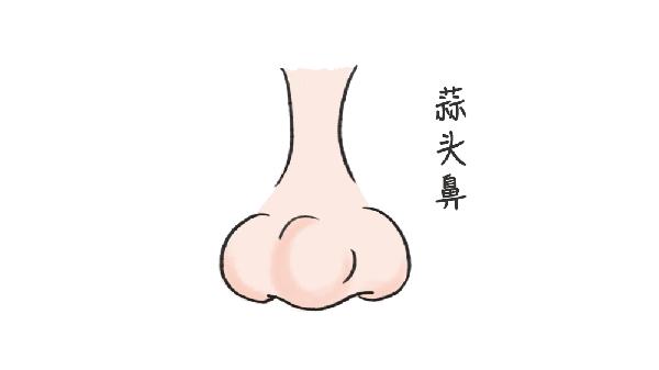 做蒜頭鼻治療手術(shù)時(shí)間是多久