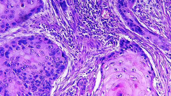 與神經(jīng)系統(tǒng)類型安靜型相對應(yīng)的氣質(zhì)是什么