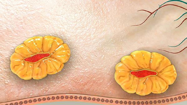 14歲女孩沒(méi)有卵巢能治療嗎