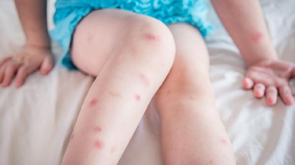 爬樓梯腿抽筋是什么原因