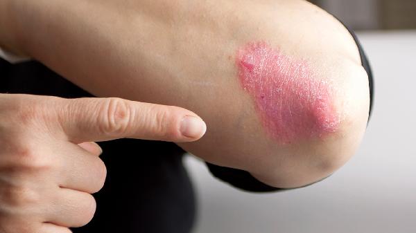 辟谷能改善皮肤吗