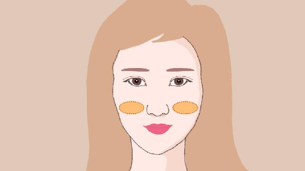 自體脂肪注射豐面頰好嗎